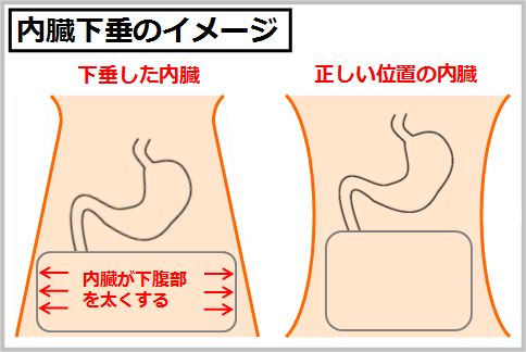 腹横筋が内臓を正しい位置に固定する
